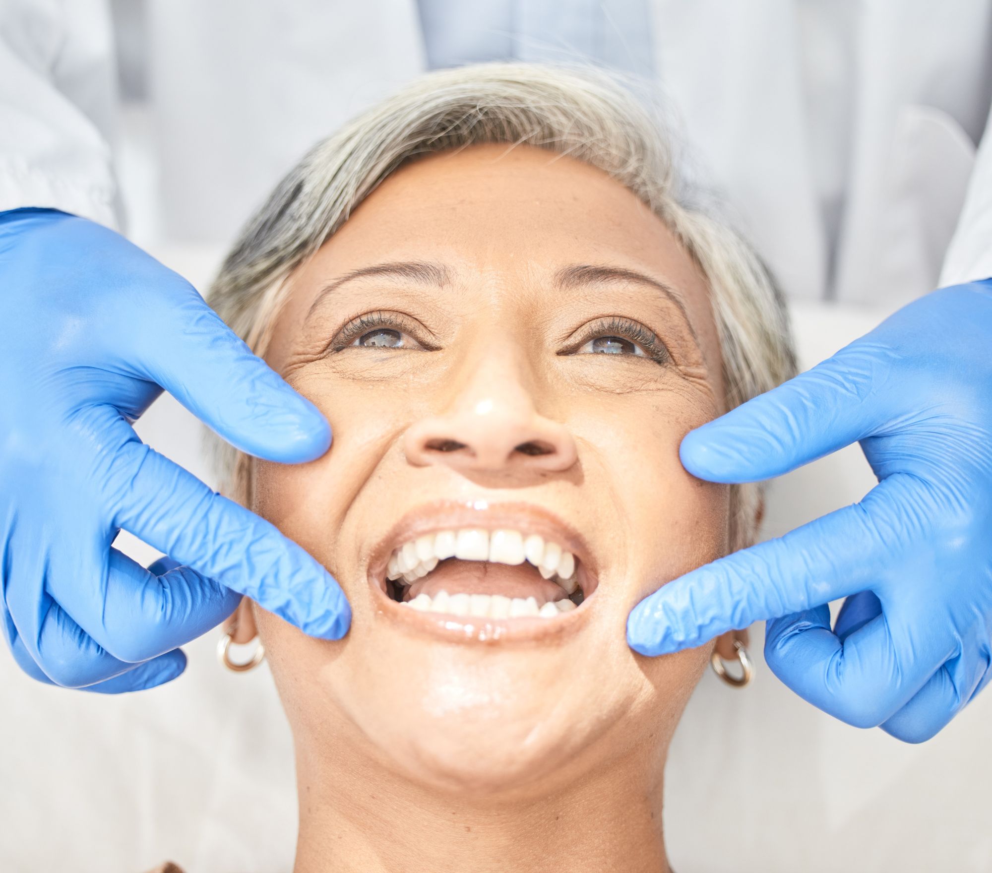 Full_Mouth _Restoration