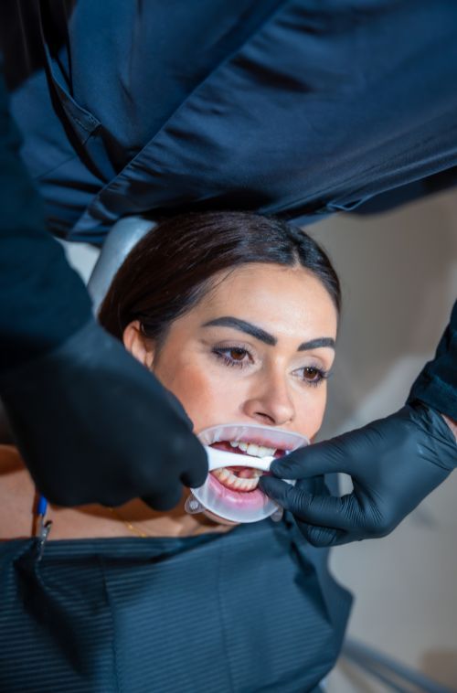 Full_Mouth _Restoration_faq