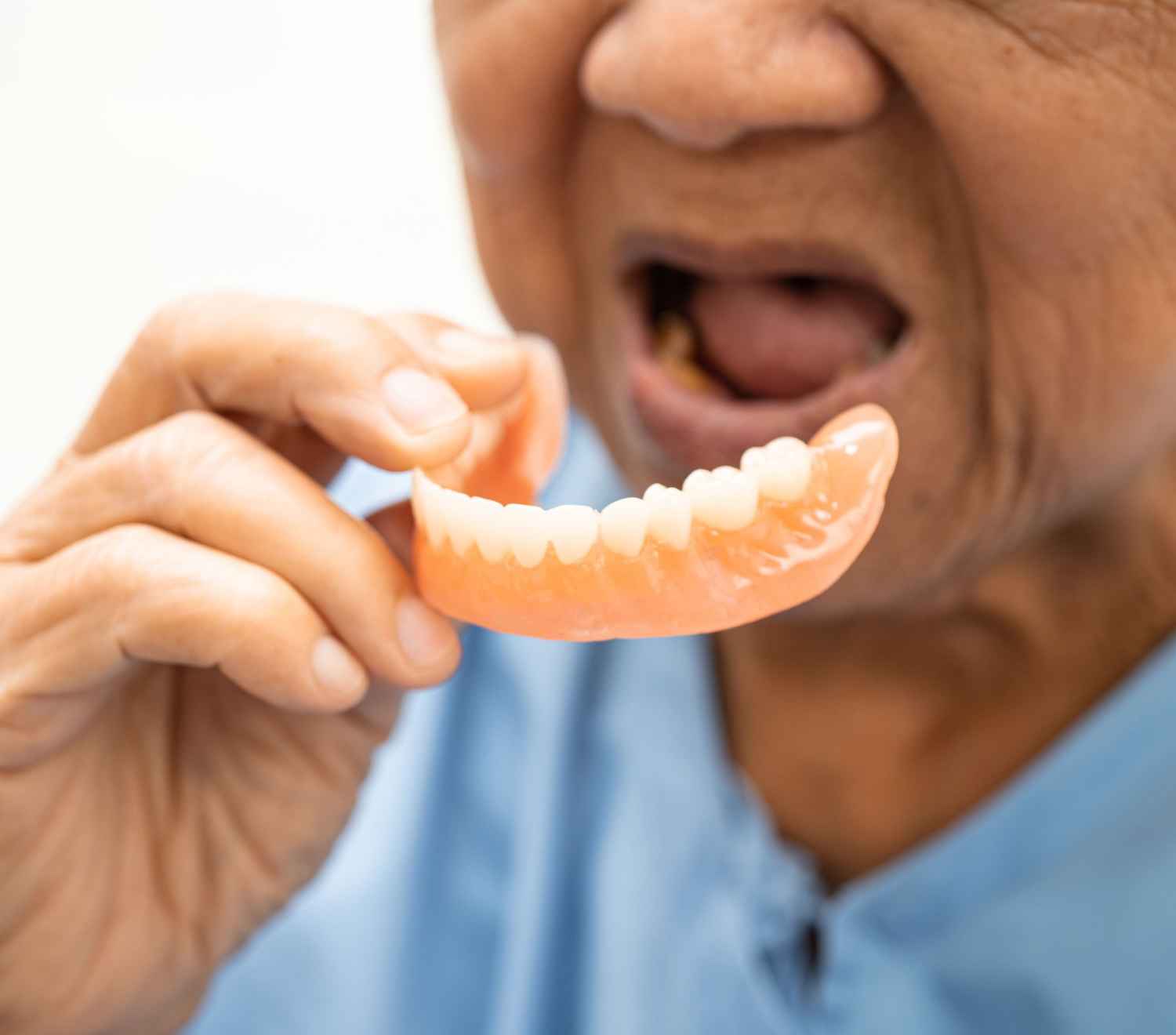 dentures 1